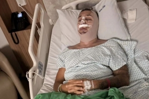 记者：西海岸外援戴维森已接受鼻梁手术 7月受伤起便一直保守治疗